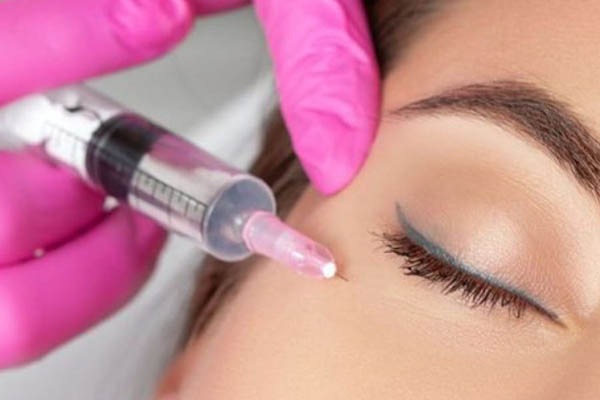 Non-Surgical Face Lifting